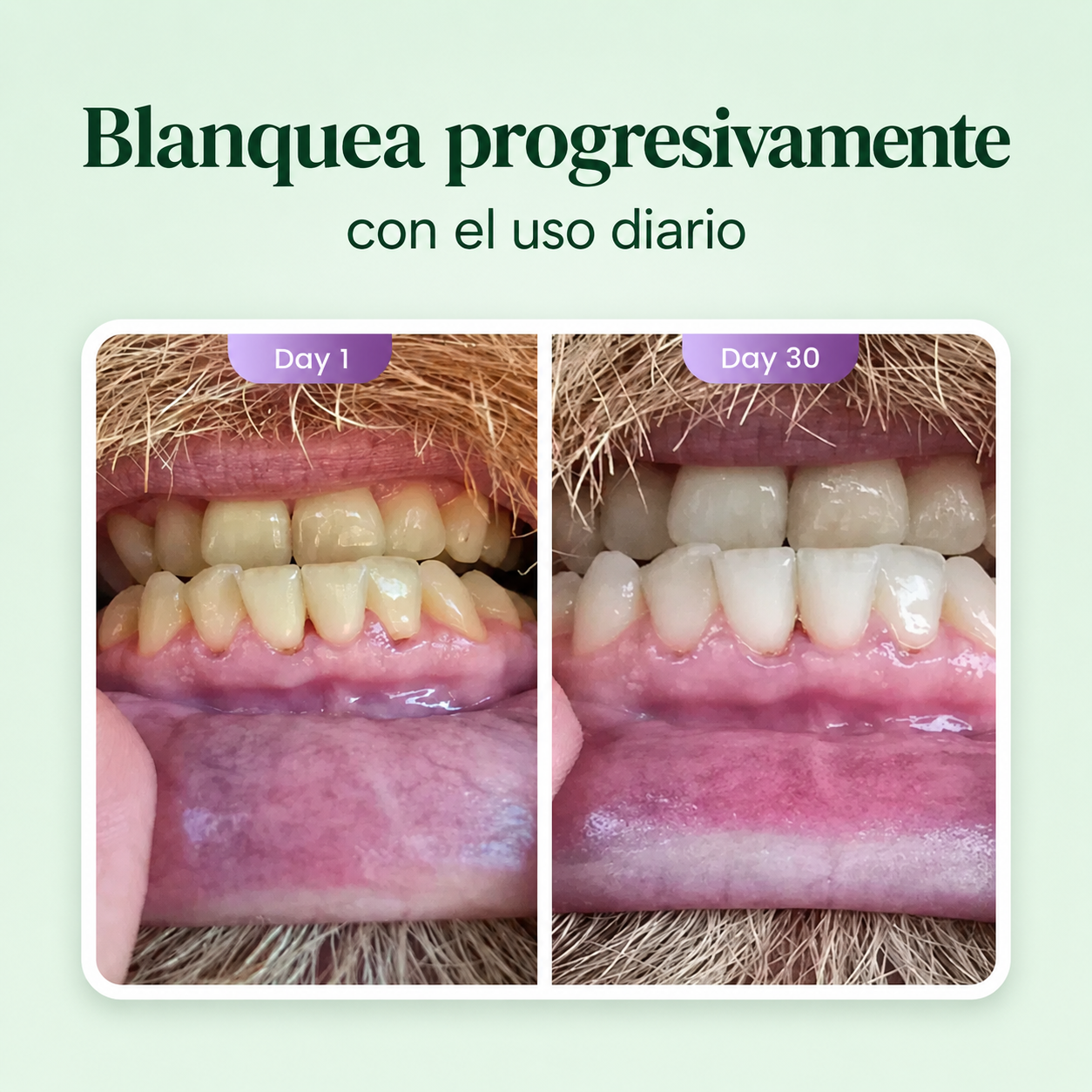 EVOLUX™ – Pasta Dental Anti Mal Aliento Sin Flúor | Blanqueado Natural Progresivo